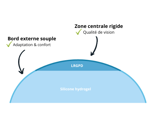 Adaptation lentilles hybrides