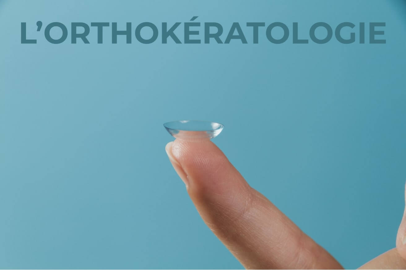 Lentilles d'orthokératologie